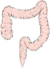 Colite - Sindrome del colon irritabile